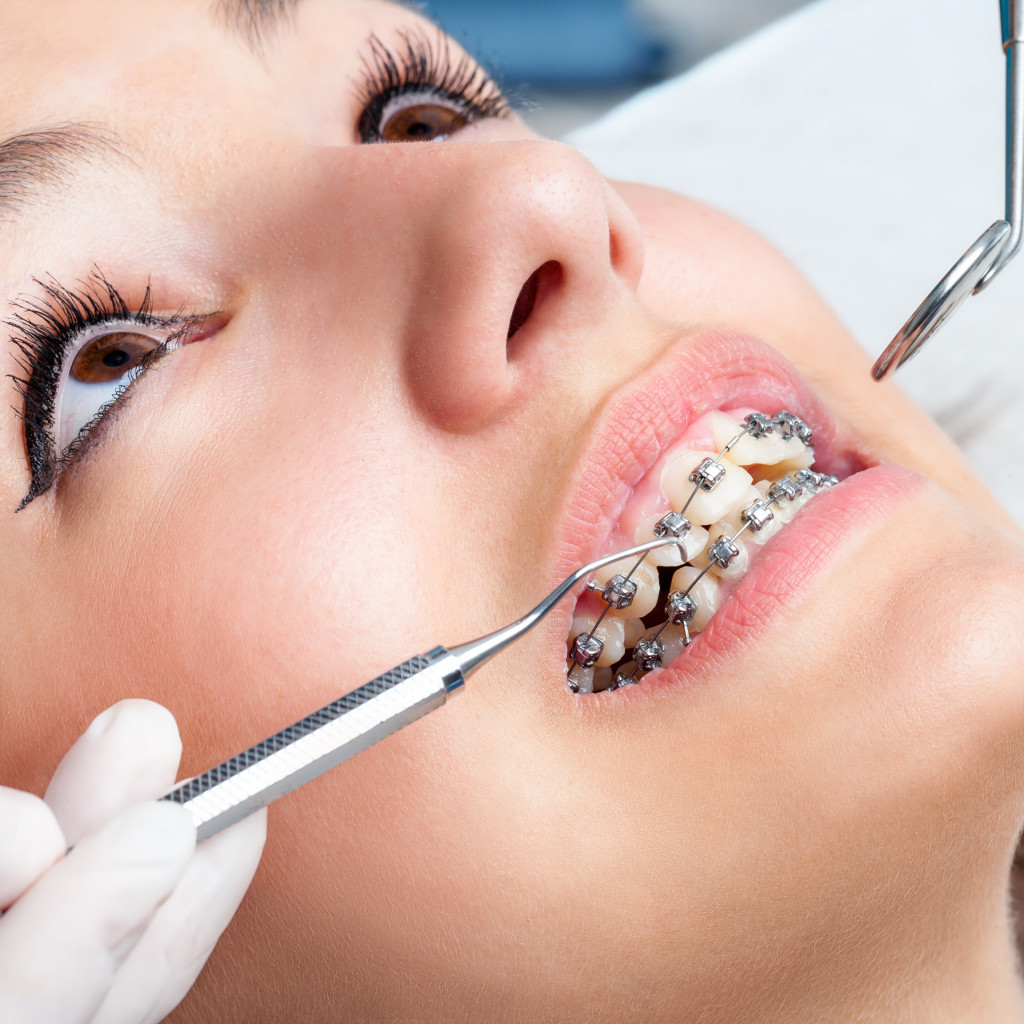 A girl wearing braces to improve her teeth